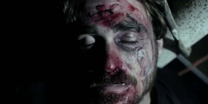 Neo-Nazi Beaten And Marked With Swastika In ‘Antifa’ Music Video by the Forward